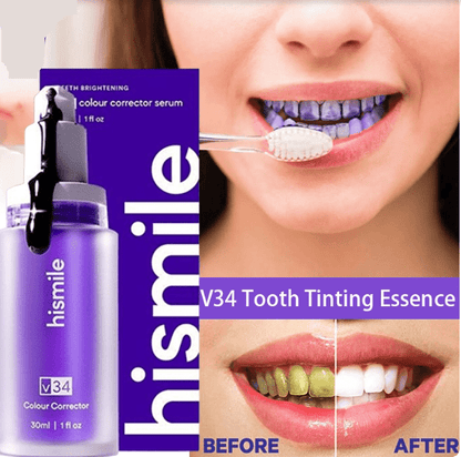 Hismile™ V34 Colour Corrector – Teeth Brightening Serum (Original, 30ml)